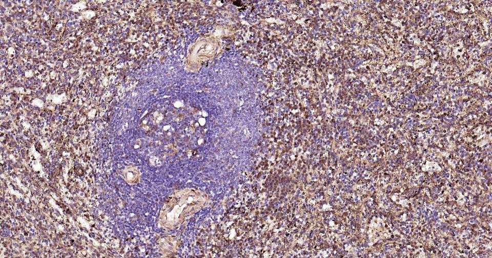 半乳糖凝集素3重组兔单抗