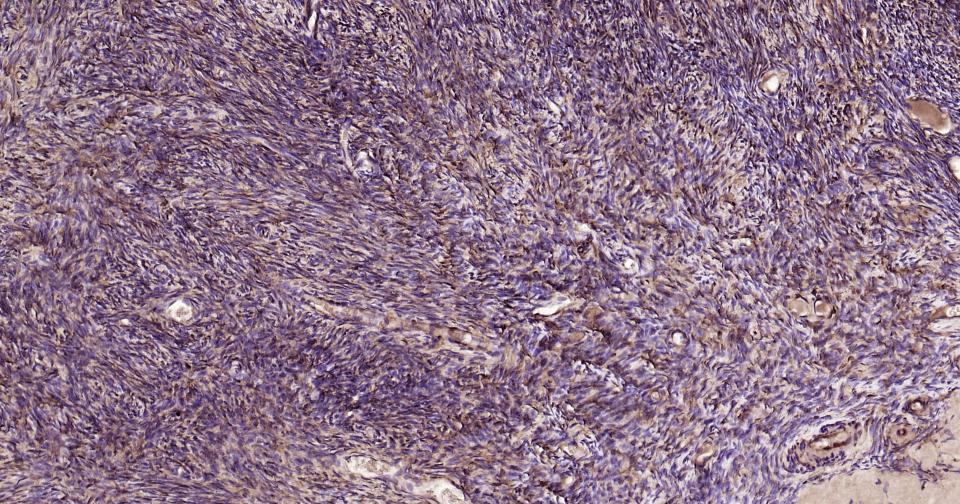 半乳糖凝集素3抗体-bs-41218R