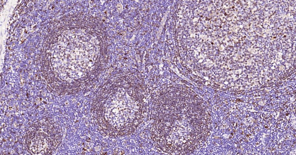 CD74重组兔单克隆抗体