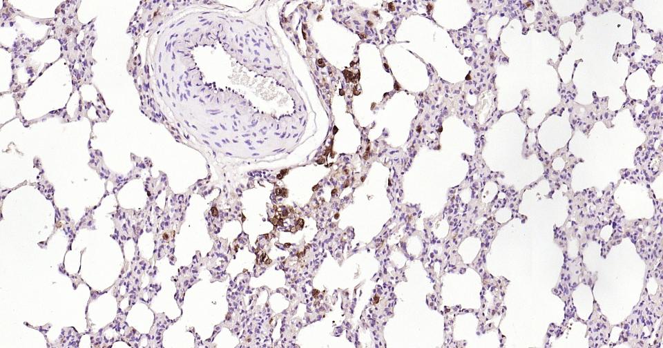 半乳糖凝集素3抗体-bs-41218R