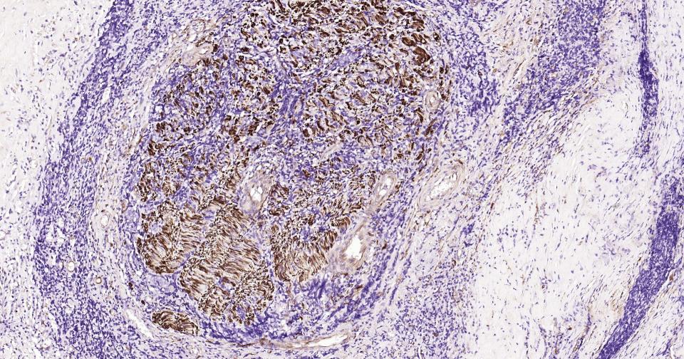 微管蛋白β3重组兔单抗