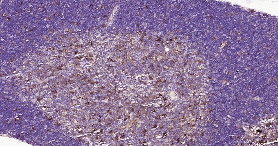 半乳糖凝集素3抗体-bs-41218R