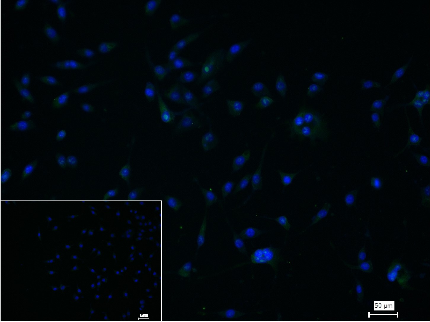 DNA甲基转移酶-3α重组兔单抗