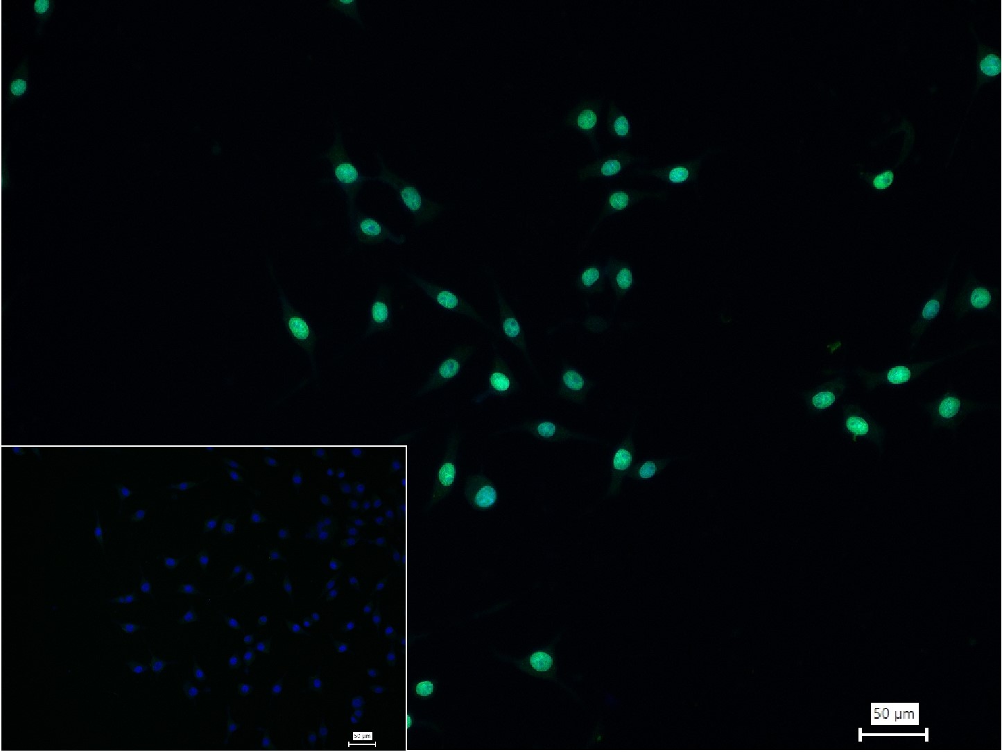 乙酰化组蛋白H3.1(Lys28)重组兔单抗