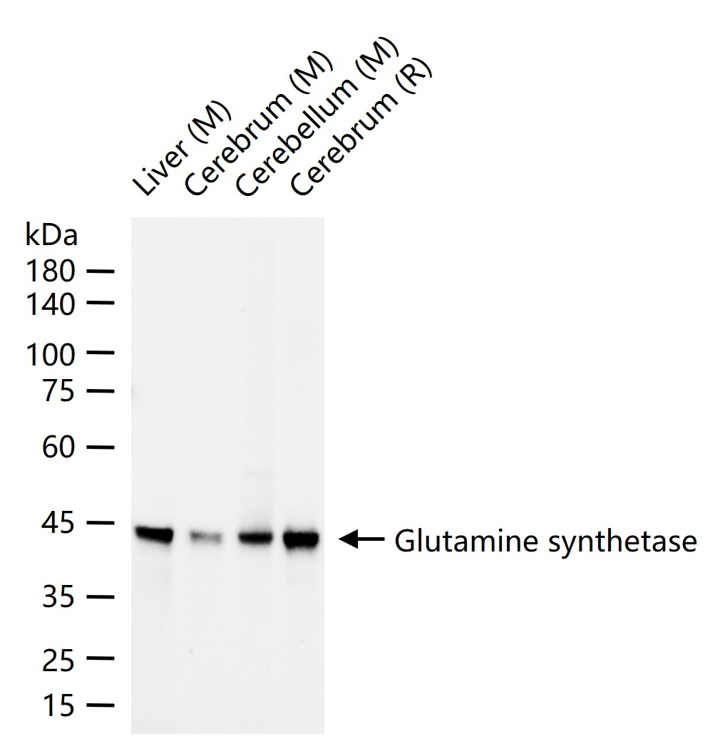谷氨酰胺合成酶/谷氨酸氨连接酶重组兔单抗