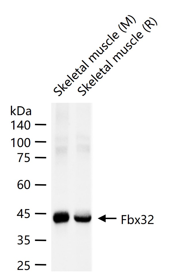 泛素蛋白连接酶重组兔单抗