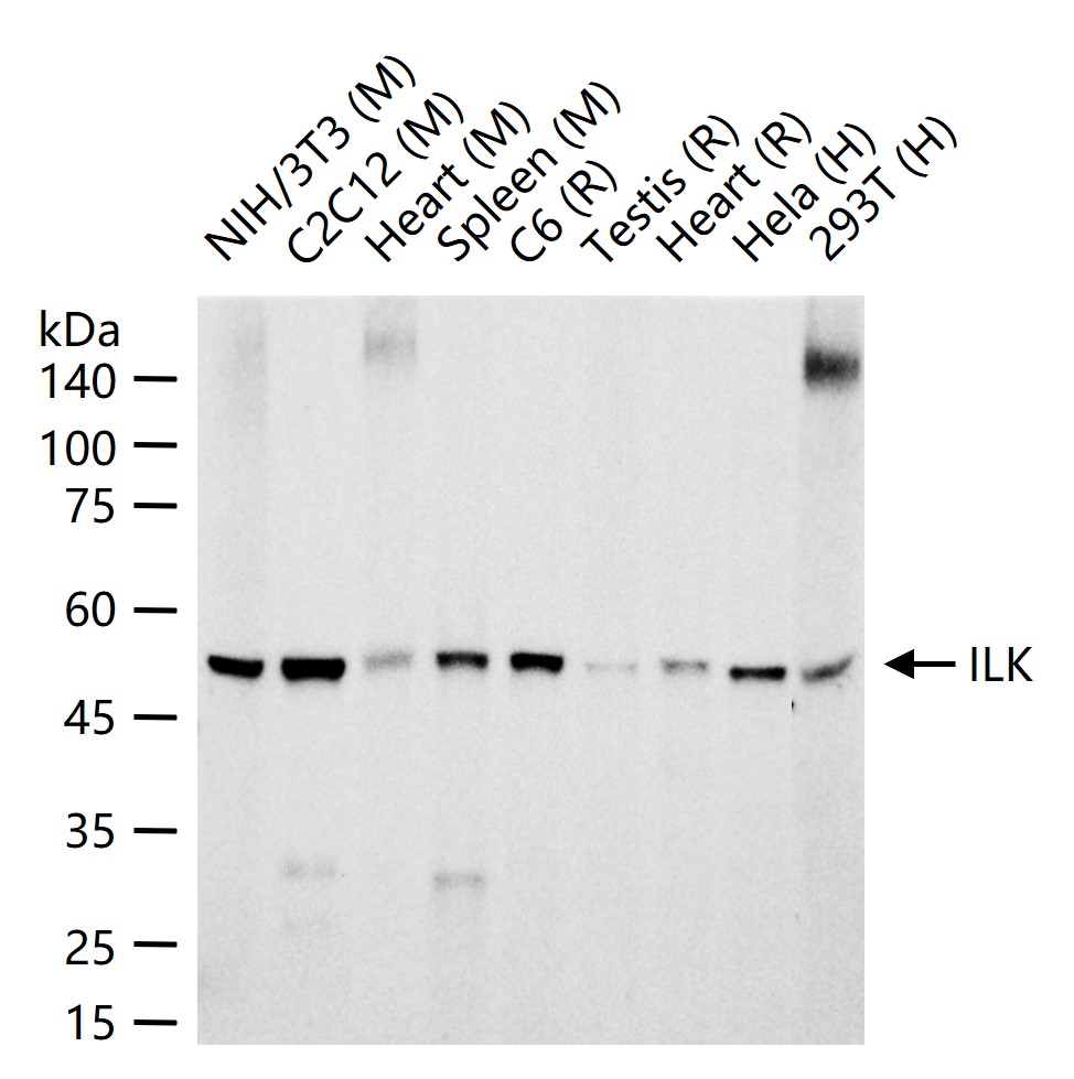 整合素连接激酶ILK重组兔单抗