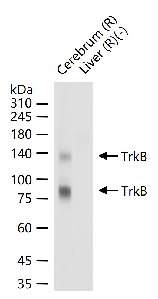 酪氨酸激酶B重组兔单抗