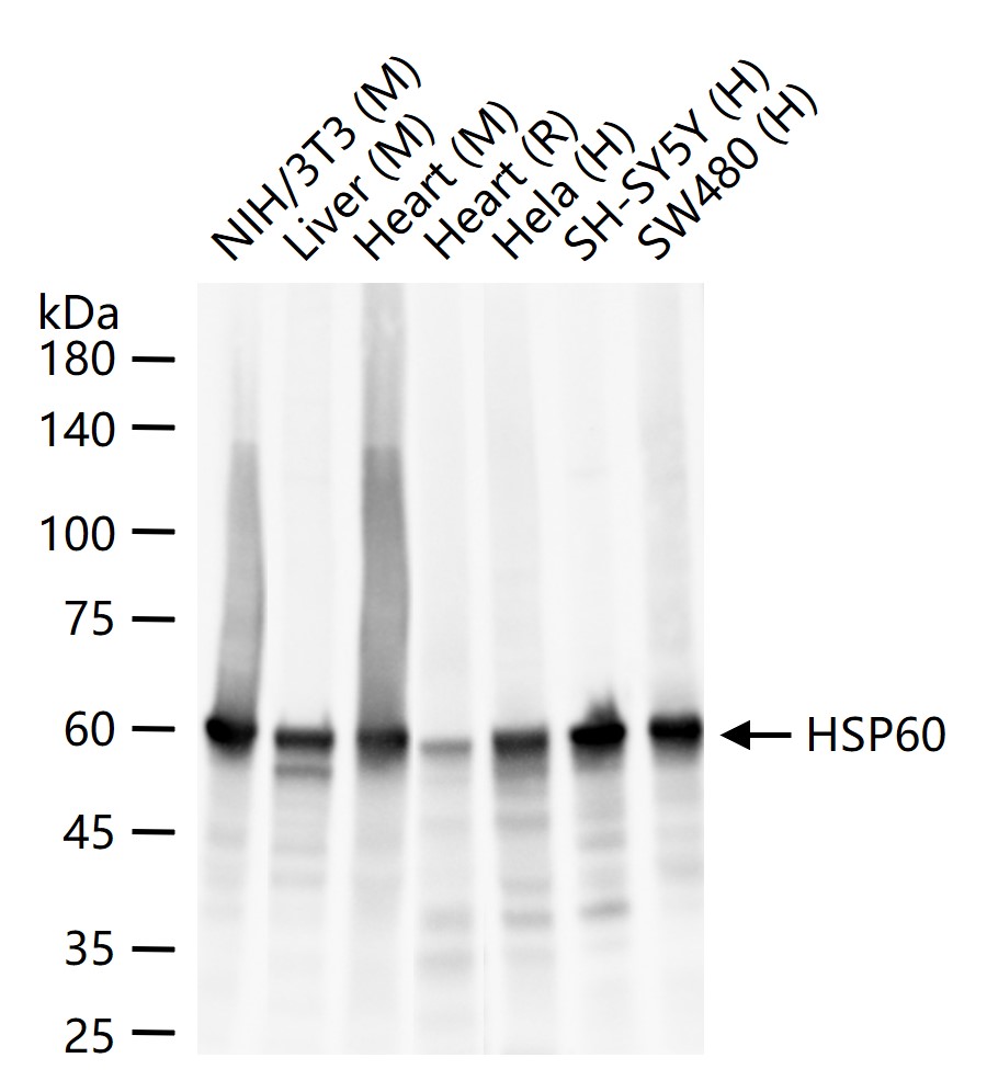 热休克蛋白-60/groEL重组兔单抗