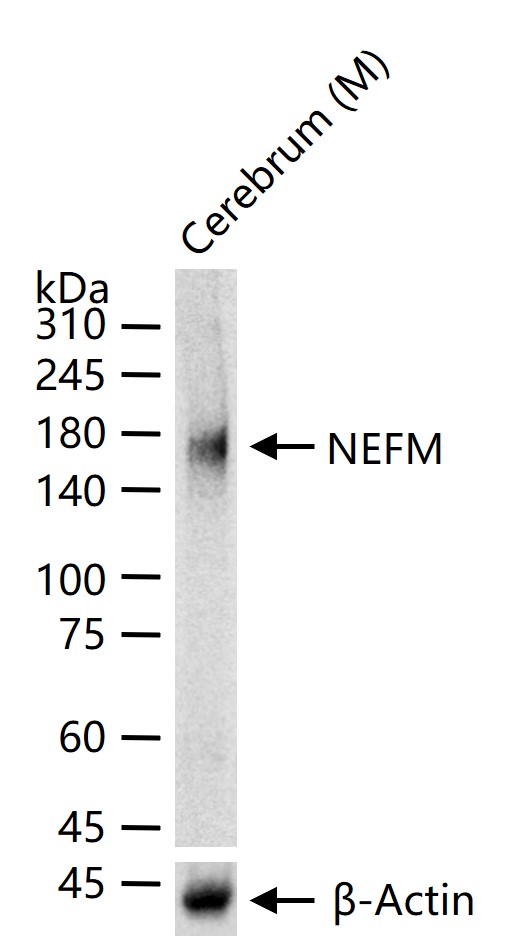 NEFM Recombinant Mouse mAb (一抗) - WB,IHC-P,IHC-F,IF | Bioss