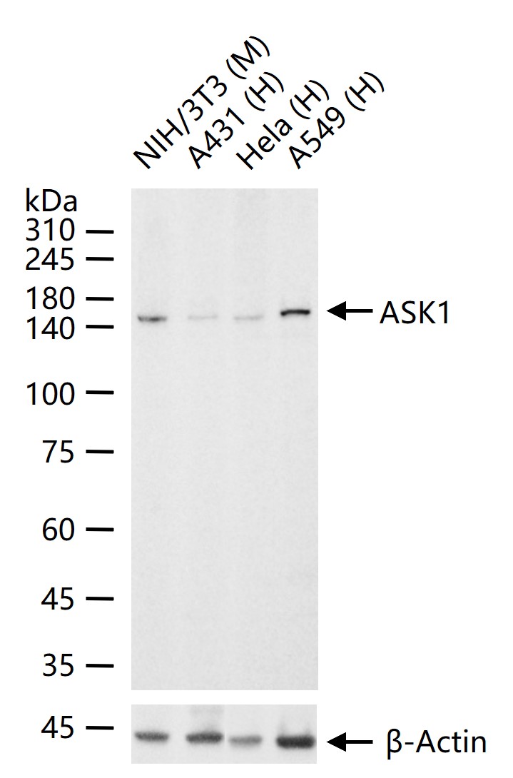 细胞凋亡信号调节激酶1重组兔单抗