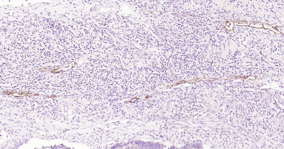 E选择素单克隆抗体-bsm-43646M