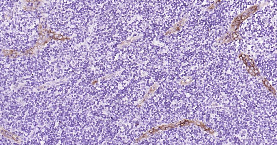 E选择素单克隆抗体-bsm-43646M