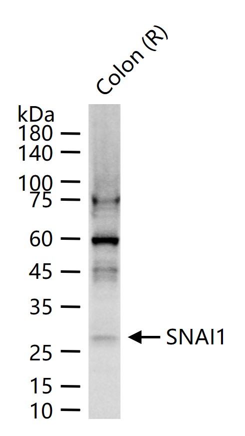 SNAI1 Rabbit pAb (一抗) - WB,IHC-P,IHC-F,IF,ELISA | Bioss