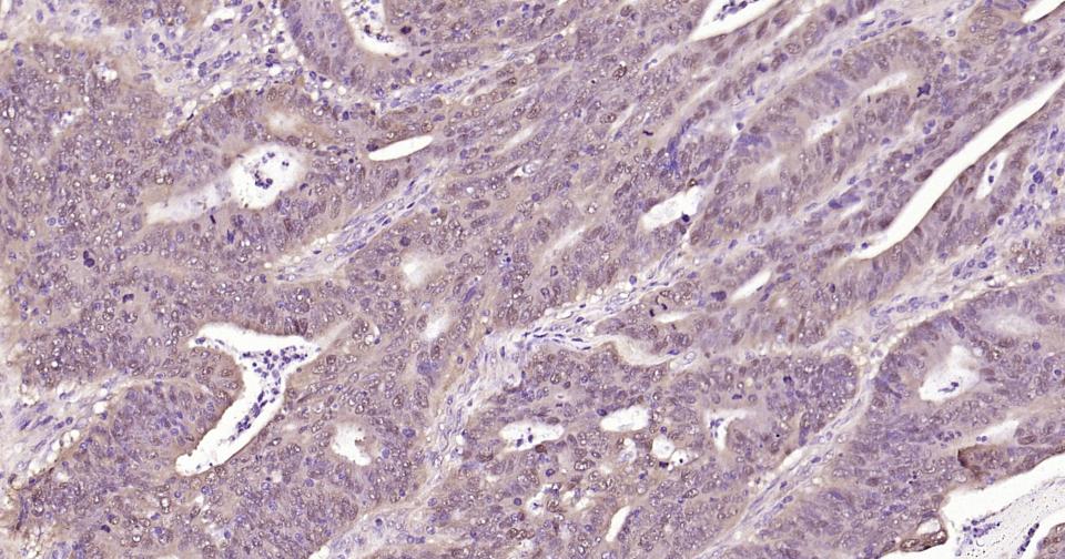 Snail蛋白抗体-bs-1371R