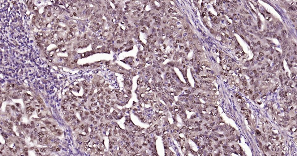 Snail蛋白抗体-bs-1371R