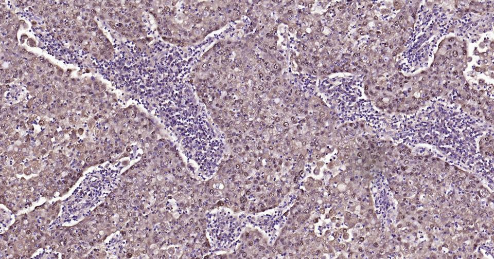 Snail蛋白抗体-bs-1371R