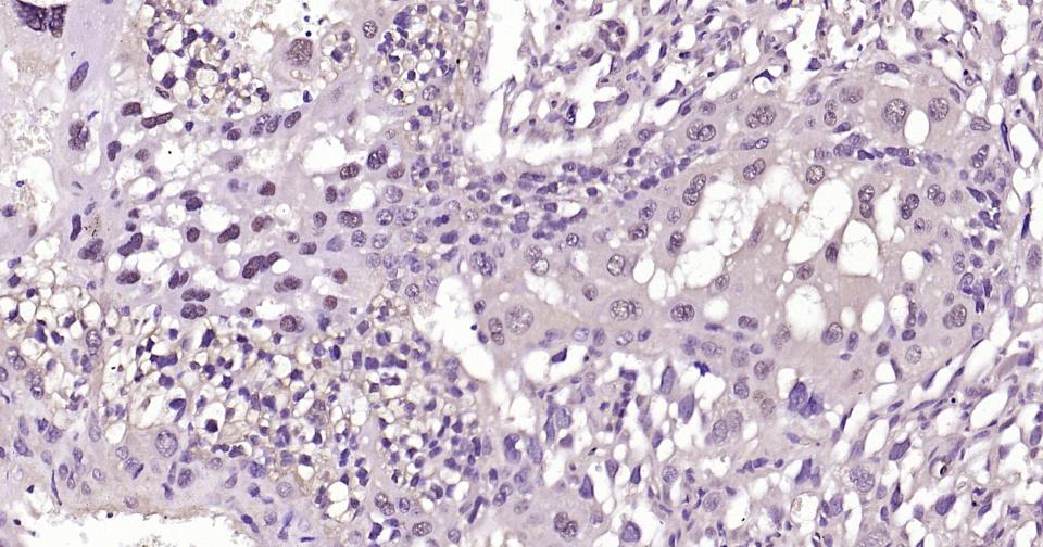 Snail蛋白抗体-bs-1371R