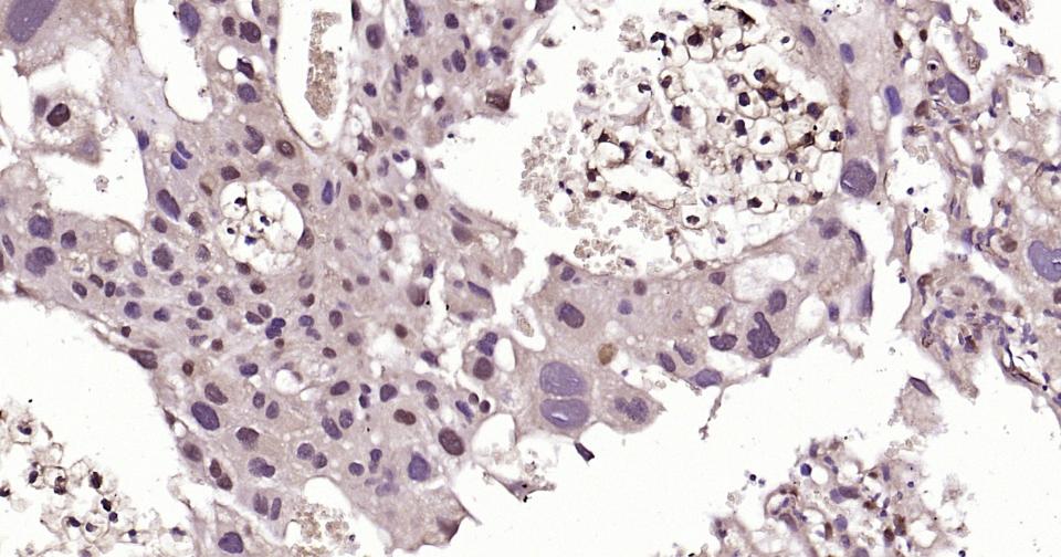 Snail蛋白抗体-bs-1371R