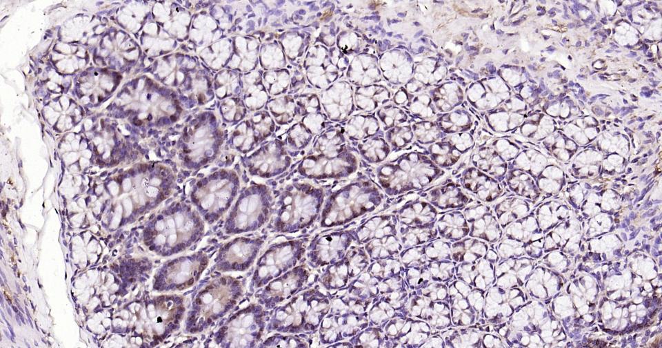 Snail蛋白抗体-bs-1371R