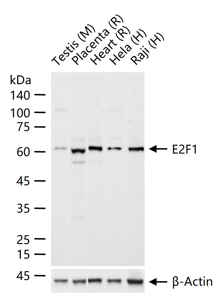 转录因子E2F-1重组兔单抗