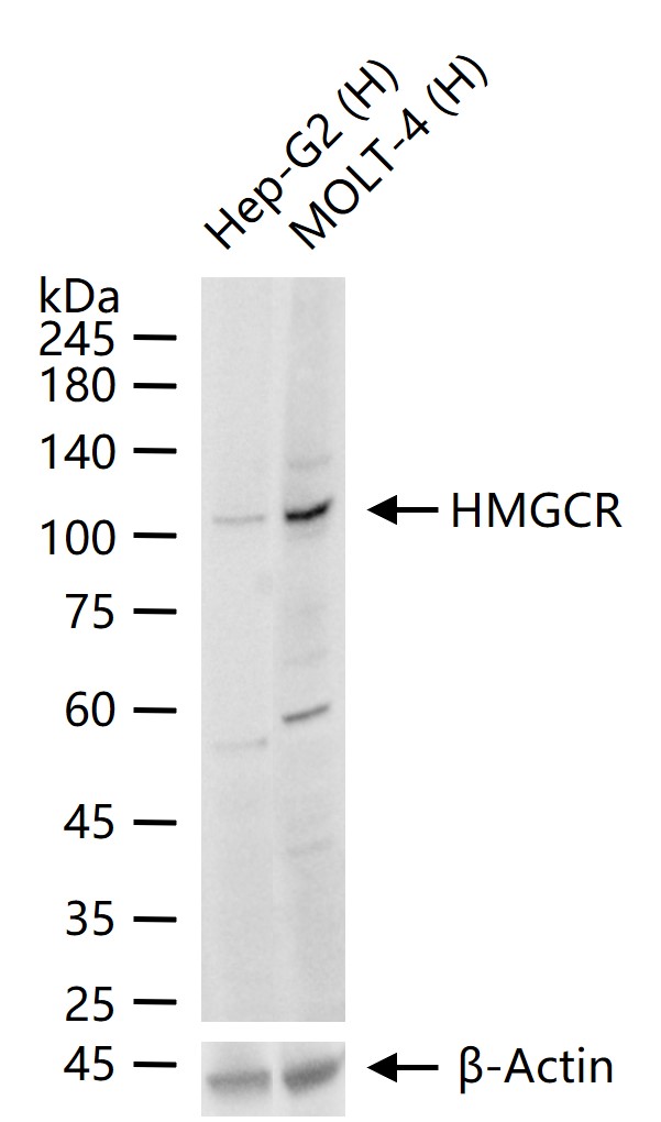 HMGCR Rabbit pAb (一抗) - WB | Bioss