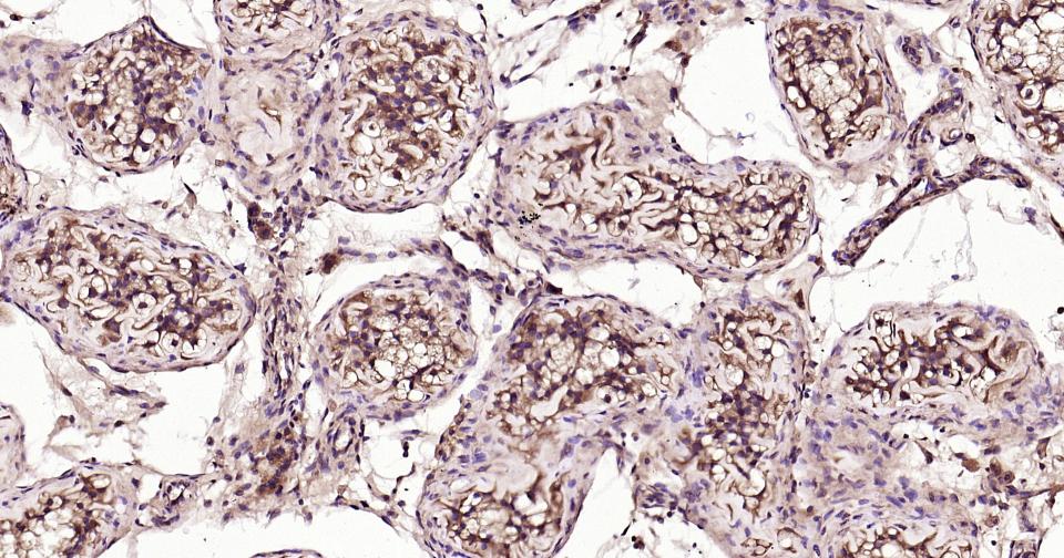 NF-κB活化激酶重组兔单抗