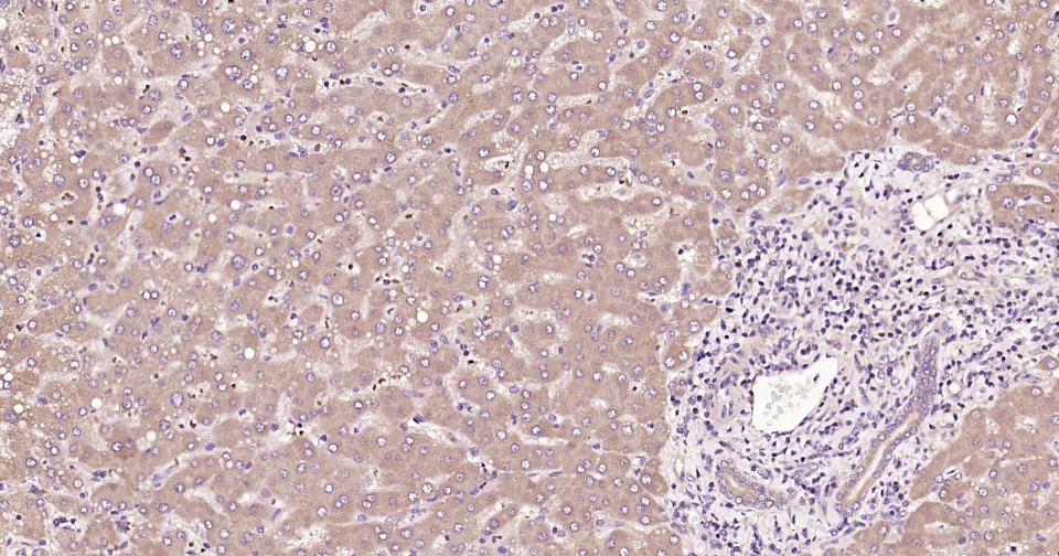 NF-κB活化激酶重组兔单抗