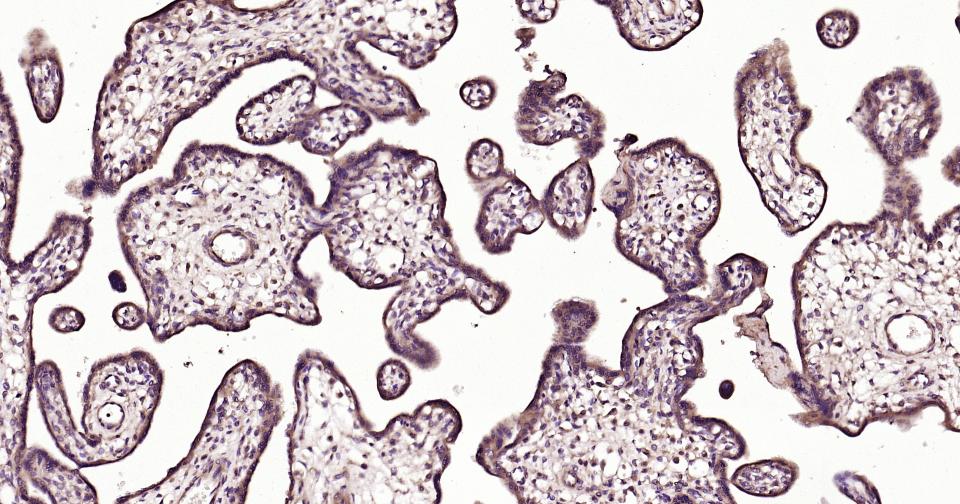 NF-κB活化激酶重组兔单抗