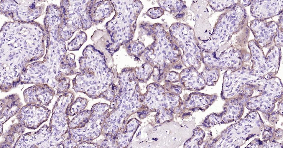 血管紧张素转换酶重组兔单抗