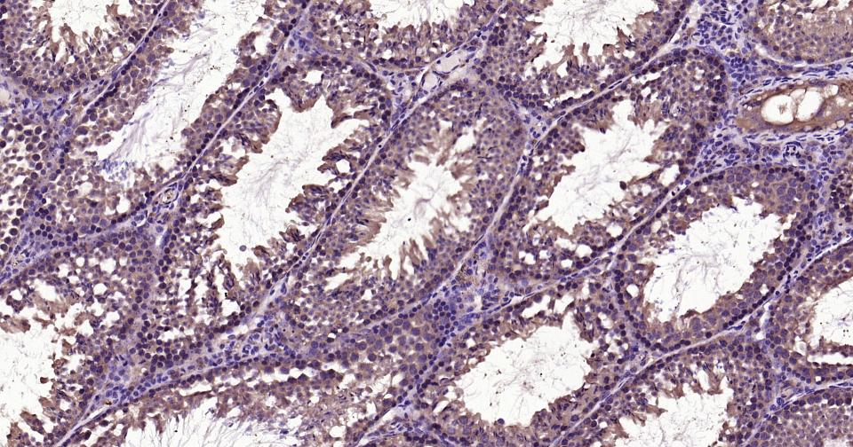 NF-κB活化激酶重组兔单抗