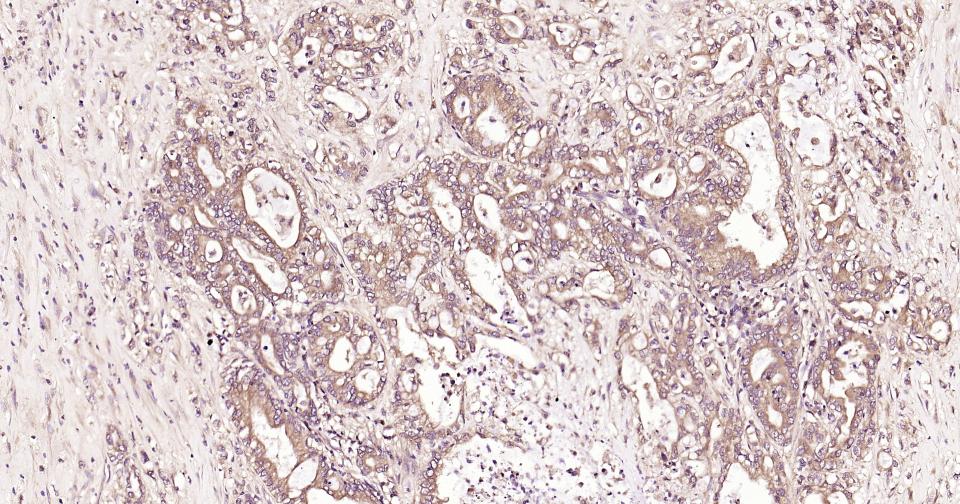 NF-κB活化激酶重组兔单抗
