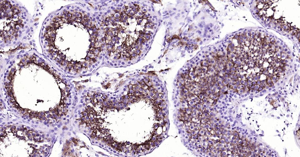 血管紧张素转换酶重组兔单抗