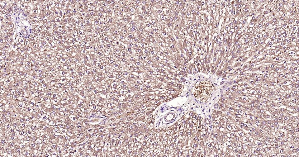 NF-κB活化激酶重组兔单抗
