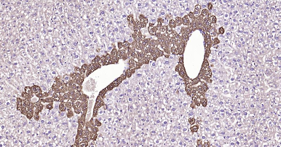 谷氨酰胺合成酶/谷氨酸氨连接酶重组兔单抗