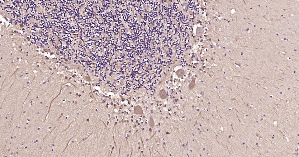 胱抑素C/半胱氨酸蛋白酶抑制剂C重组兔单抗