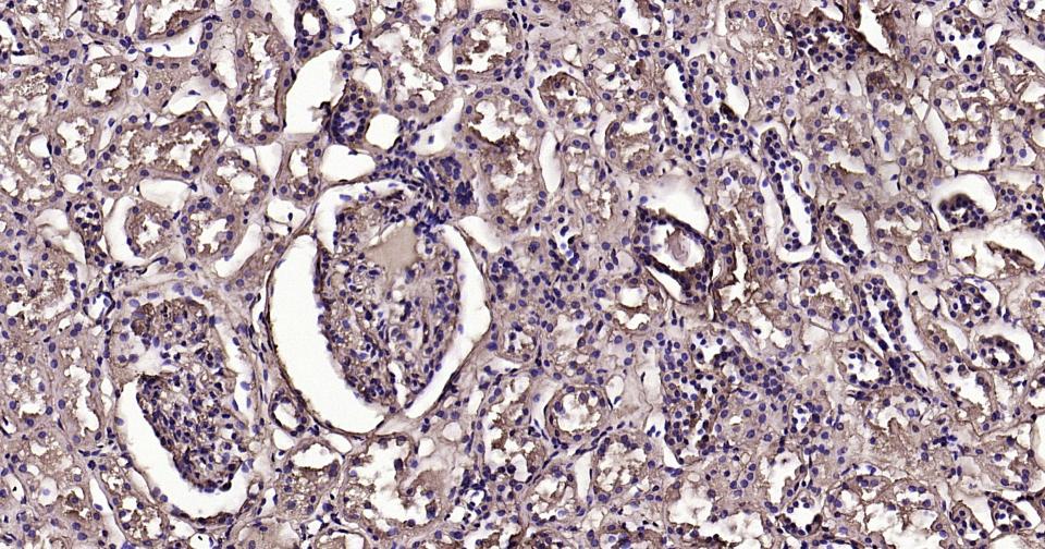 钙调节素重组兔单抗
