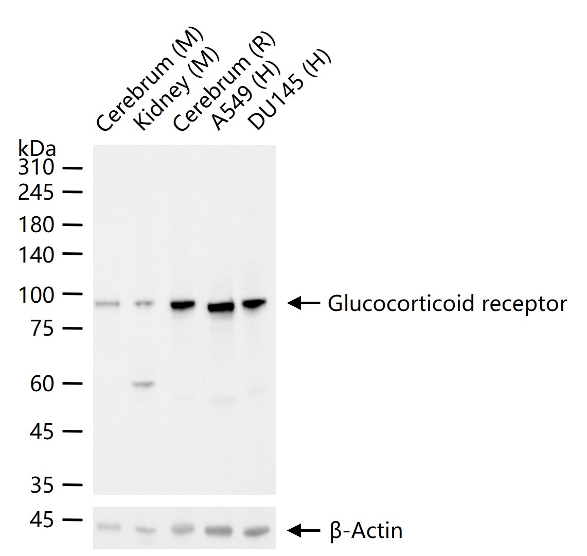 糖皮质激素受体重组兔单抗