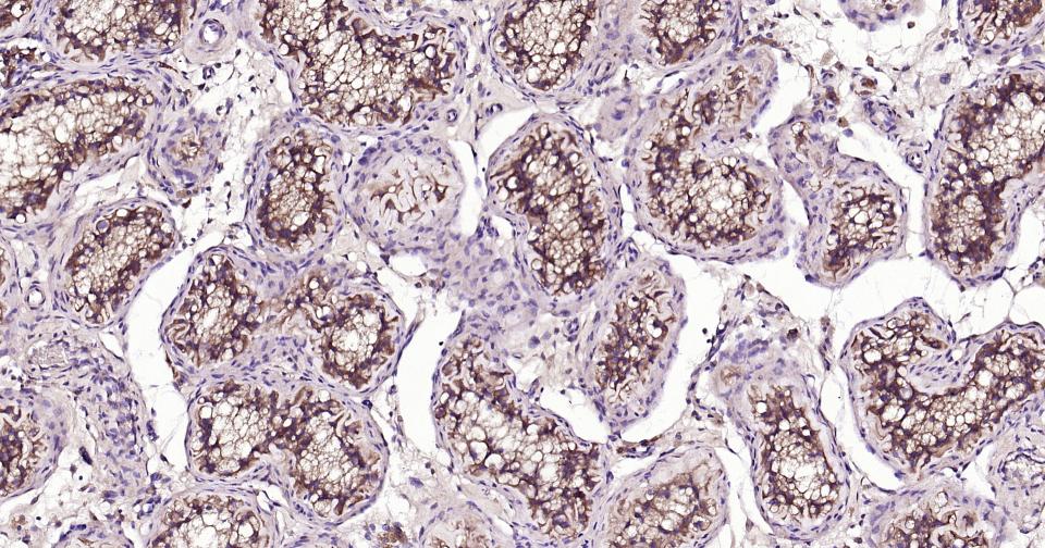 细胞凋亡信号调节激酶1重组兔单抗