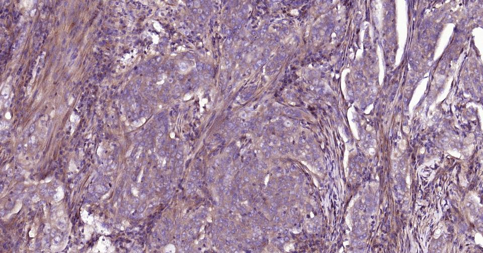 死亡相关蛋白激酶1重组兔单抗