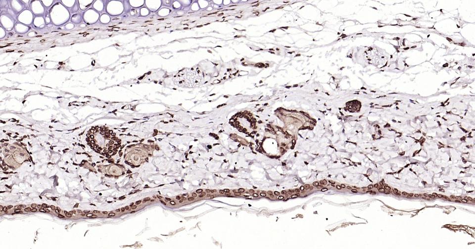 转录因子E2F-1重组兔单抗