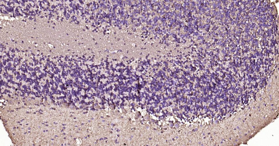 谷氨酰胺合成酶/谷氨酸氨连接酶重组兔单抗