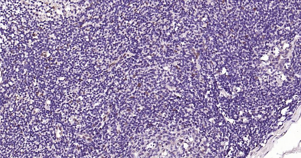 转录因子E2F-1重组兔单抗