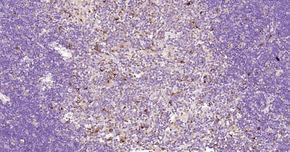 胱抑素C/半胱氨酸蛋白酶抑制剂C重组兔单抗