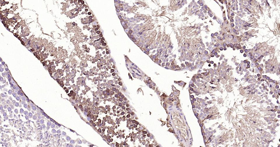 胱抑素C/半胱氨酸蛋白酶抑制剂C重组兔单抗