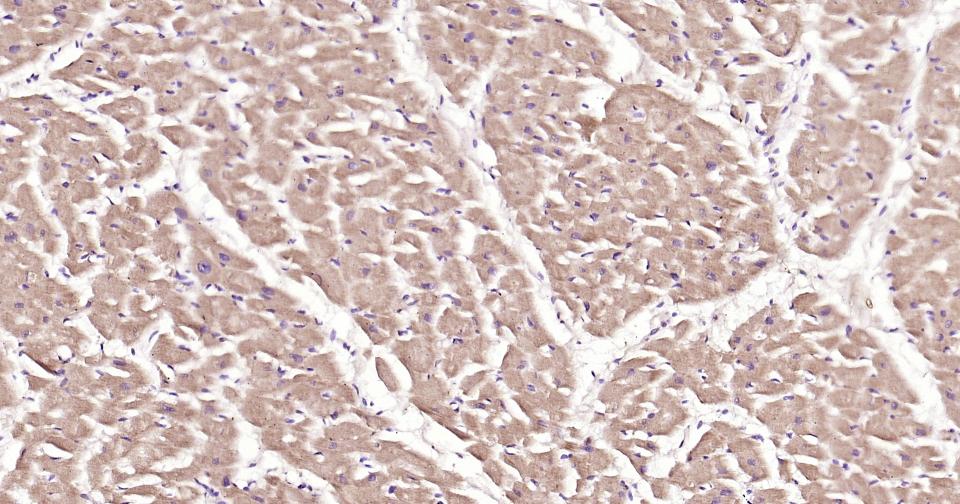 细胞凋亡信号调节激酶1重组兔单抗