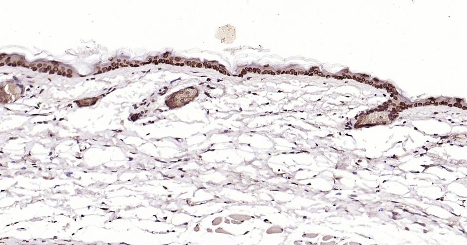转录因子E2F-1重组兔单抗