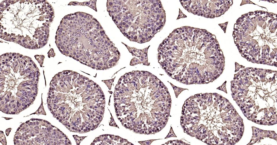 钙调节素重组兔单抗