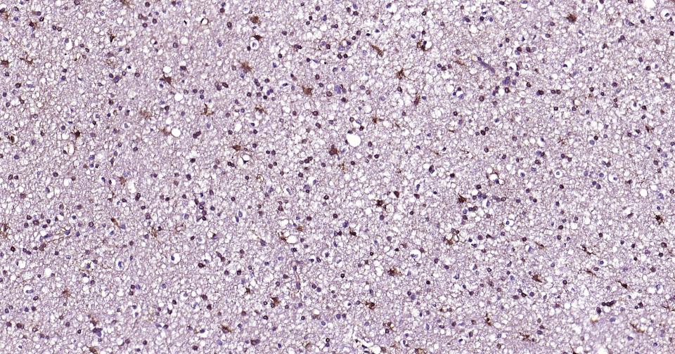 谷氨酰胺合成酶/谷氨酸氨连接酶重组兔单抗