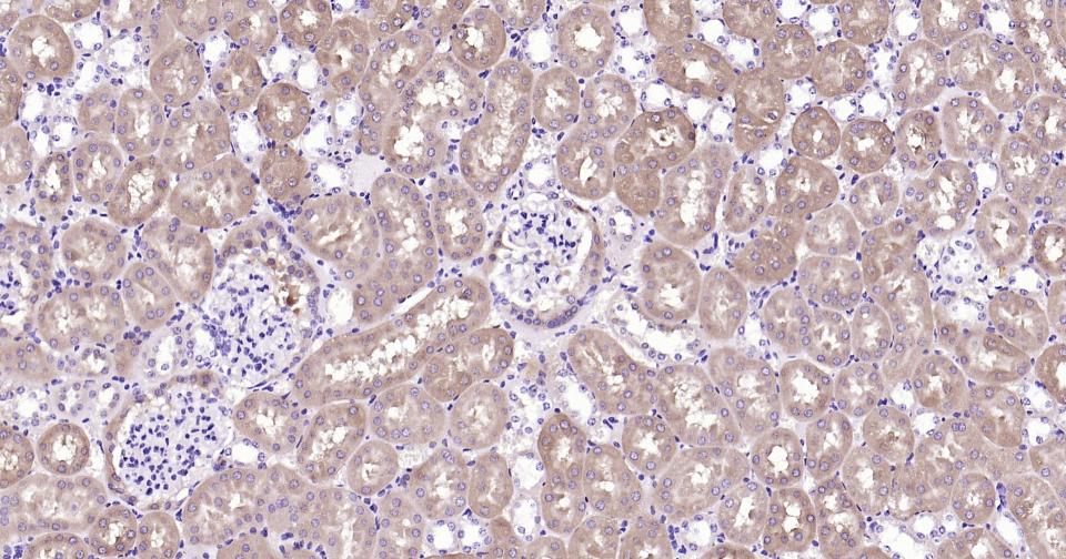 谷氨酰胺合成酶/谷氨酸氨连接酶重组兔单抗